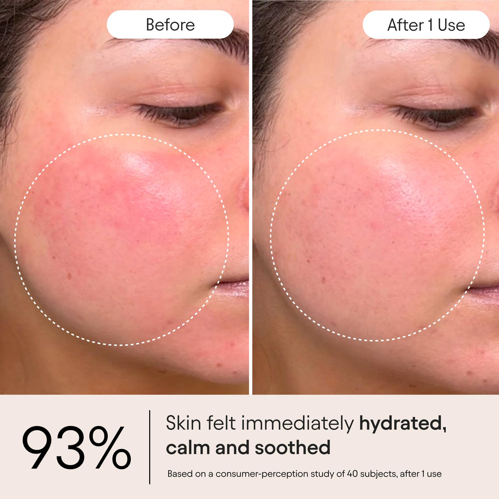 Alpyn Ceramide Complex illustration underscores moisture binding and barrier reinforcement