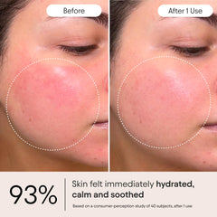 Alpyn Ceramide Complex illustration underscores moisture binding and barrier reinforcement