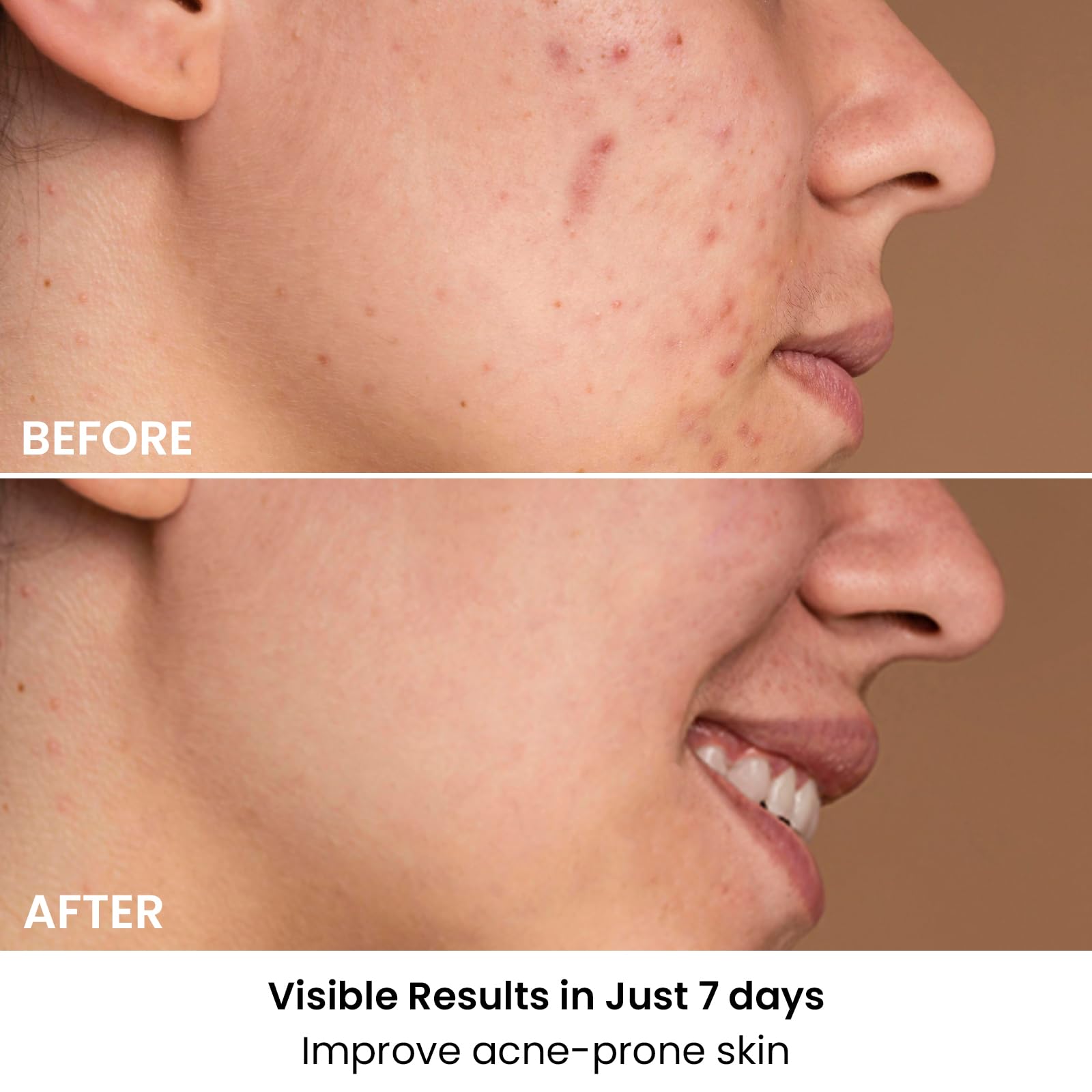 AMIRO Spectra 5in1 modes active for targeted skincare goals