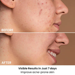 AMIRO Spectra 5in1 modes active for targeted skincare goals
