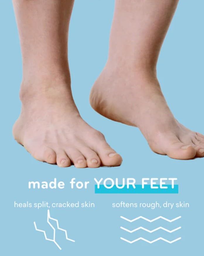 AmLactin Foot Cream Therapy before-after-feet shows improved texture