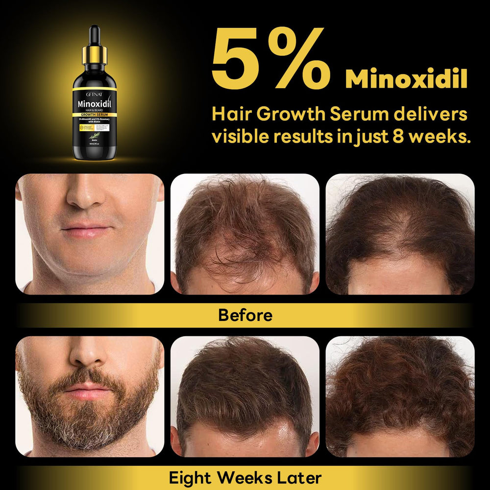 Andelusita 5% minoxidil beard-application shot for early growth.