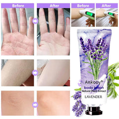 ANKOOY travel-size lotion bottles arranged for on-the-go moisture