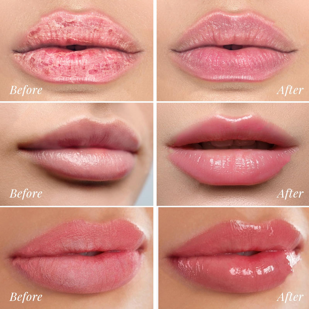 ANRCOLLECT lip mask-packaging-box highlights gift-ready packaging.