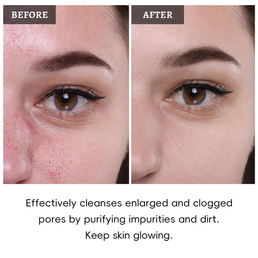 ANRCOLLECT skin-glow-refresh emphasizes a refreshed, vibrant look.