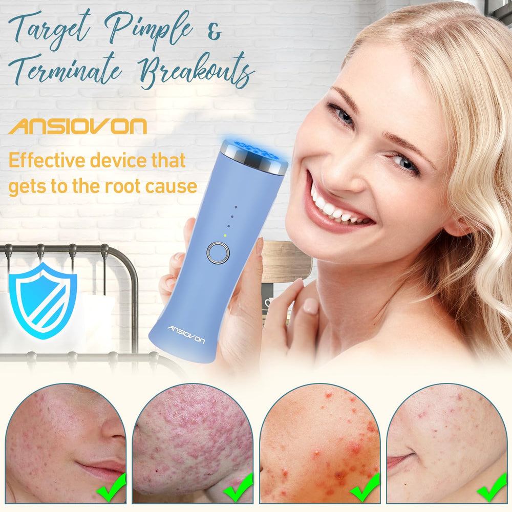 ANSIOVON blue-light therapy device LED close-up for at-home skincare routines.