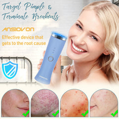 ANSIOVON blue-light therapy device LED close-up for at-home skincare routines.