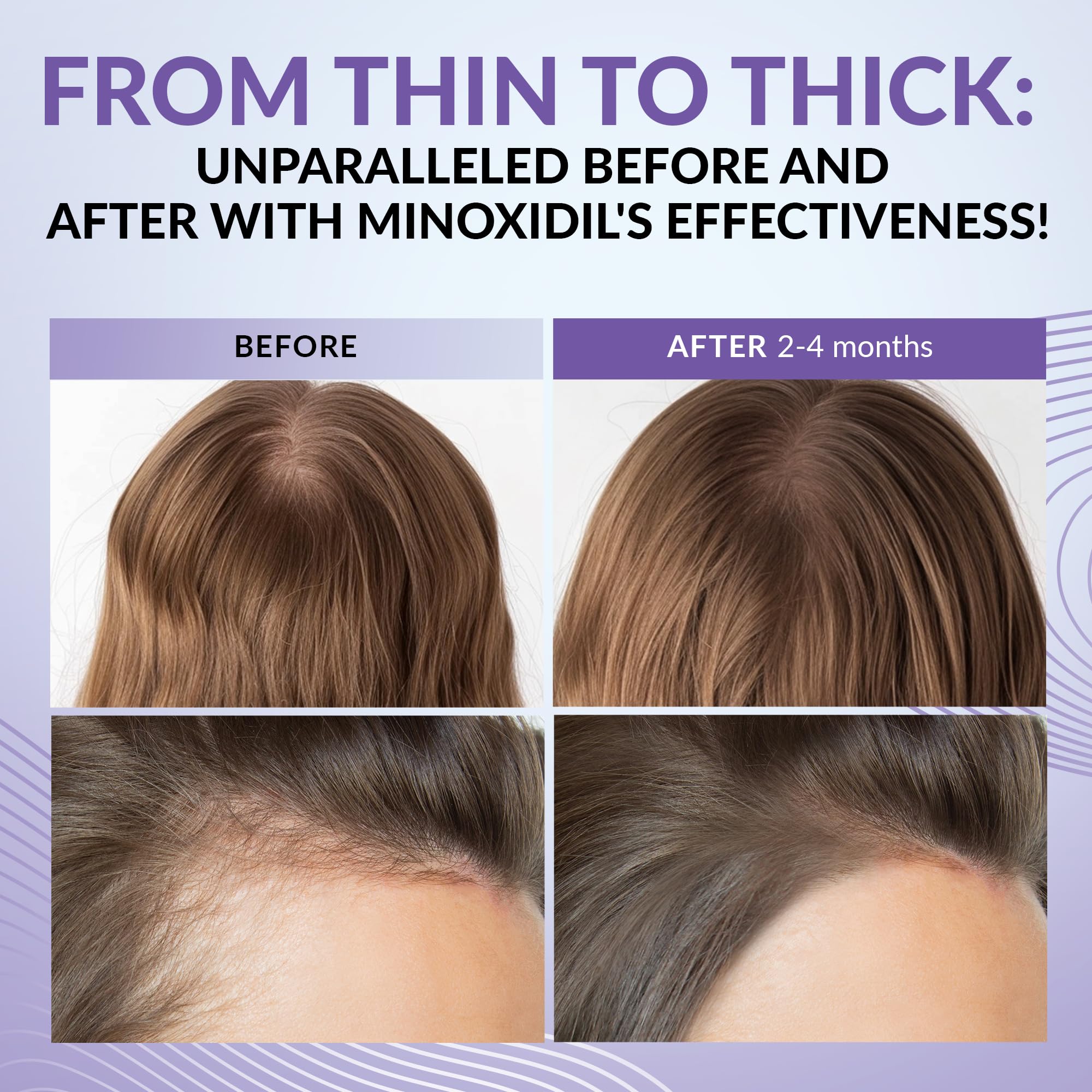 ANTROLIFE Minoxidil 2% ingredients scene shows biotin, ginseng, and ginger.