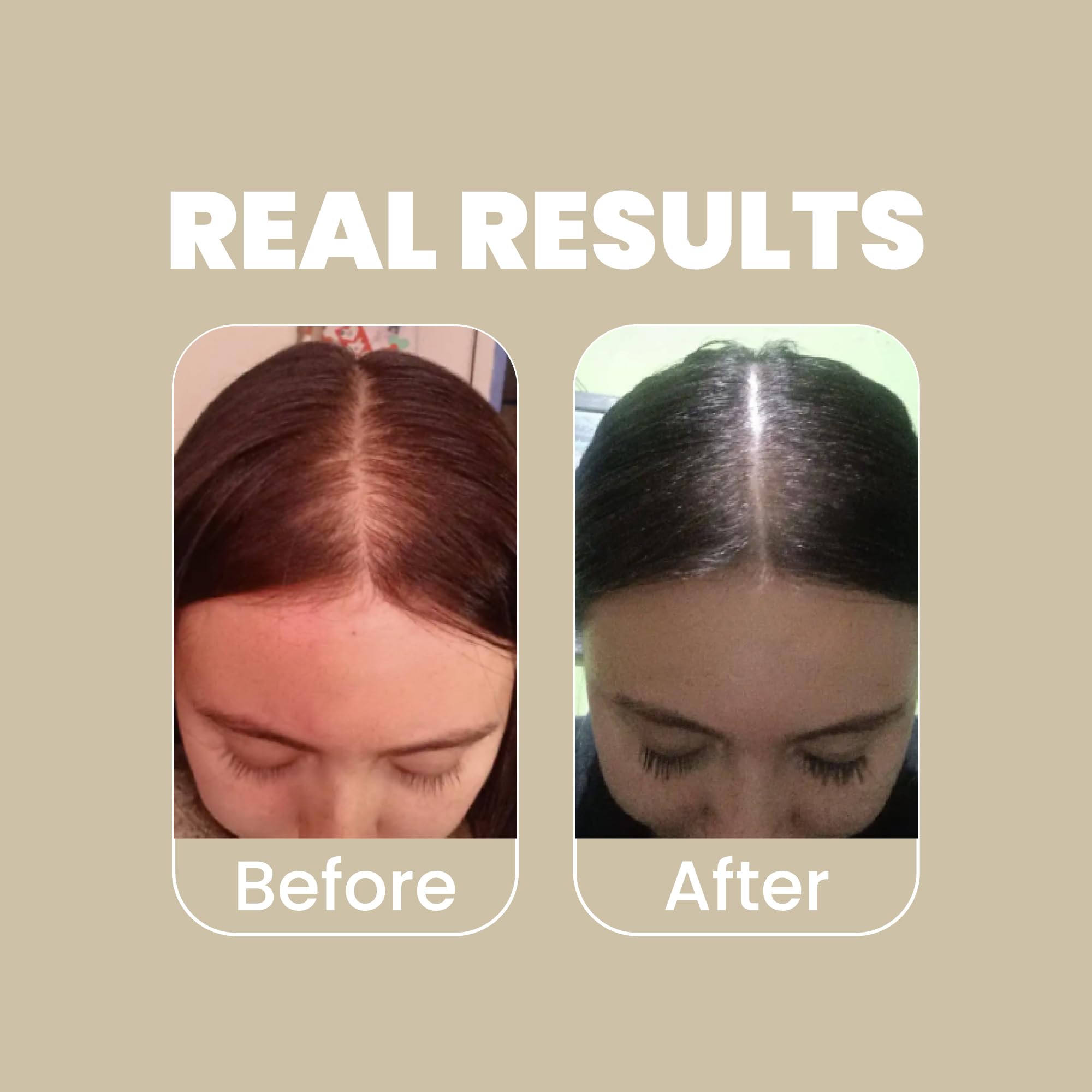 ANYELUZ hyaluronic acid ingredient graphic highlighting light, balanced hydration