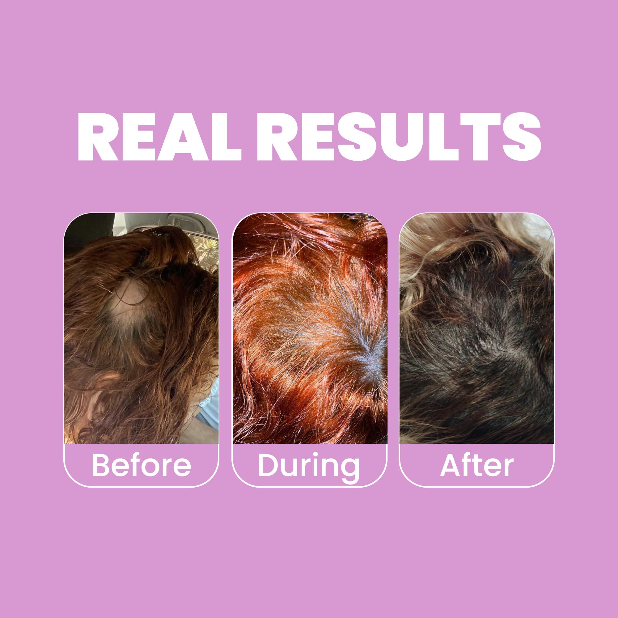 Anyeluz Onion Shampoo on sink demonstrates daily oil-control cleanse