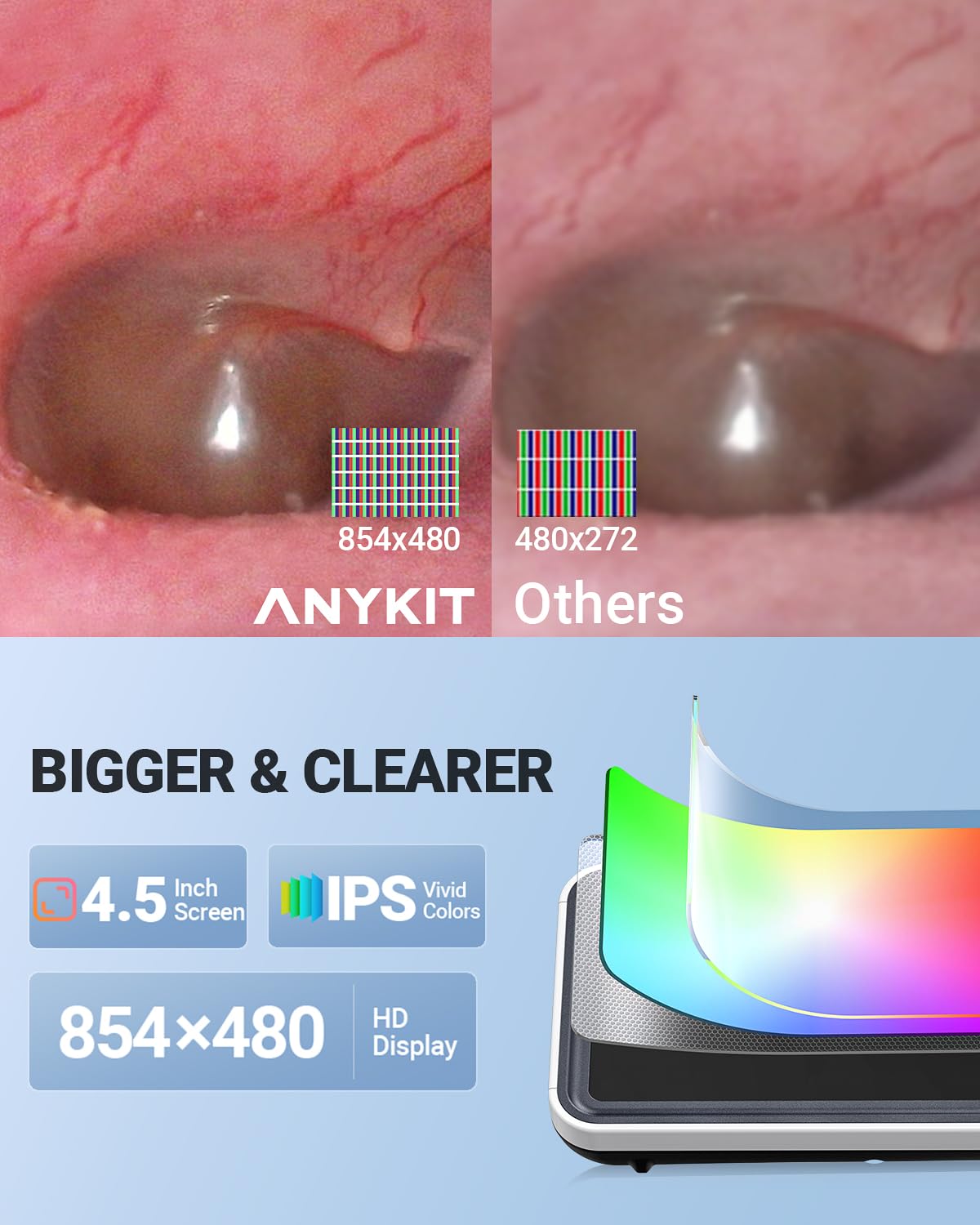 Anykit otoscope 32gb storage saves photos and videos for later review.