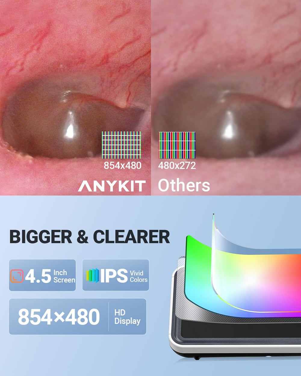 Anykit otoscope 32gb storage saves photos and videos for later review.