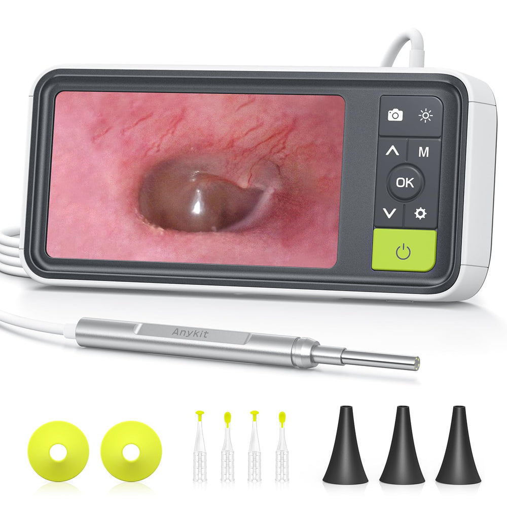 Anykit otoscope gyroscope view demonstrates stable orientation for clear ear inspection.
