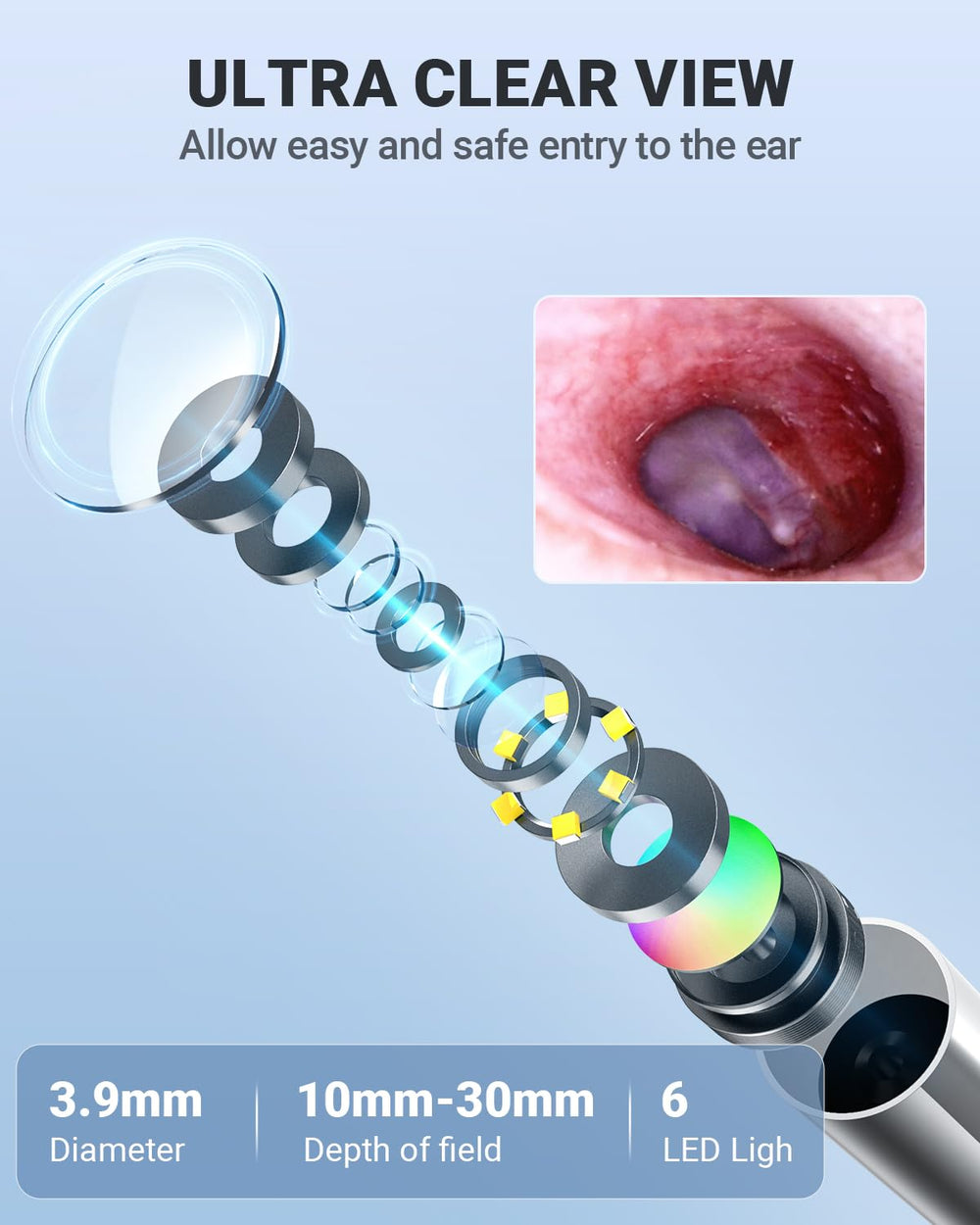 Anykit otoscope safety attachments include protective covers and specula for safer use.
