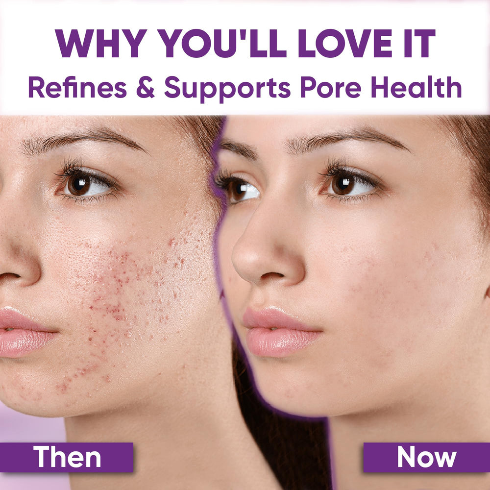 AOBBIY Azelaic Cream helps even skin tone in daily routine.