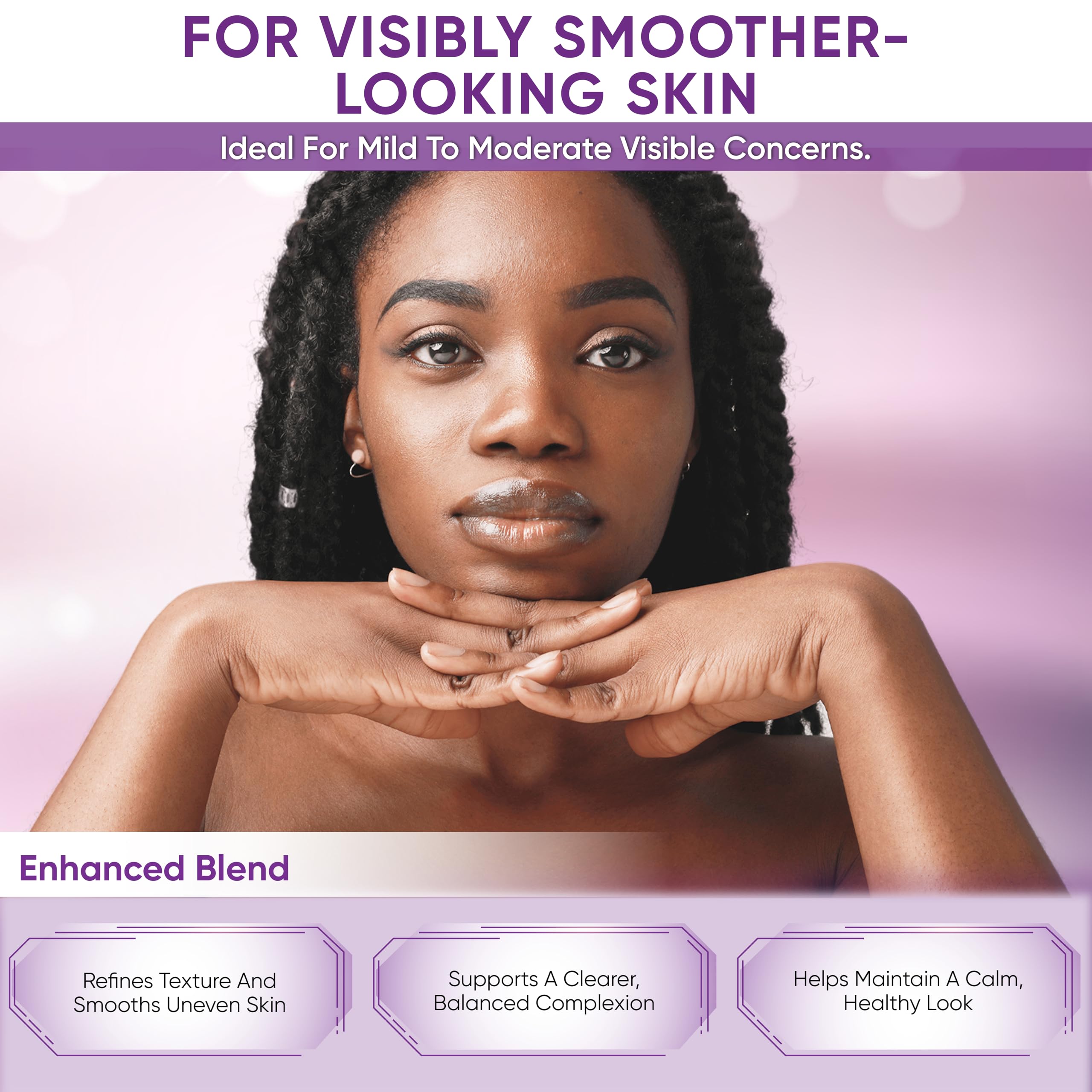 AOBBIY Azelaic Acid Cream on the face shows calm even-toned skin.