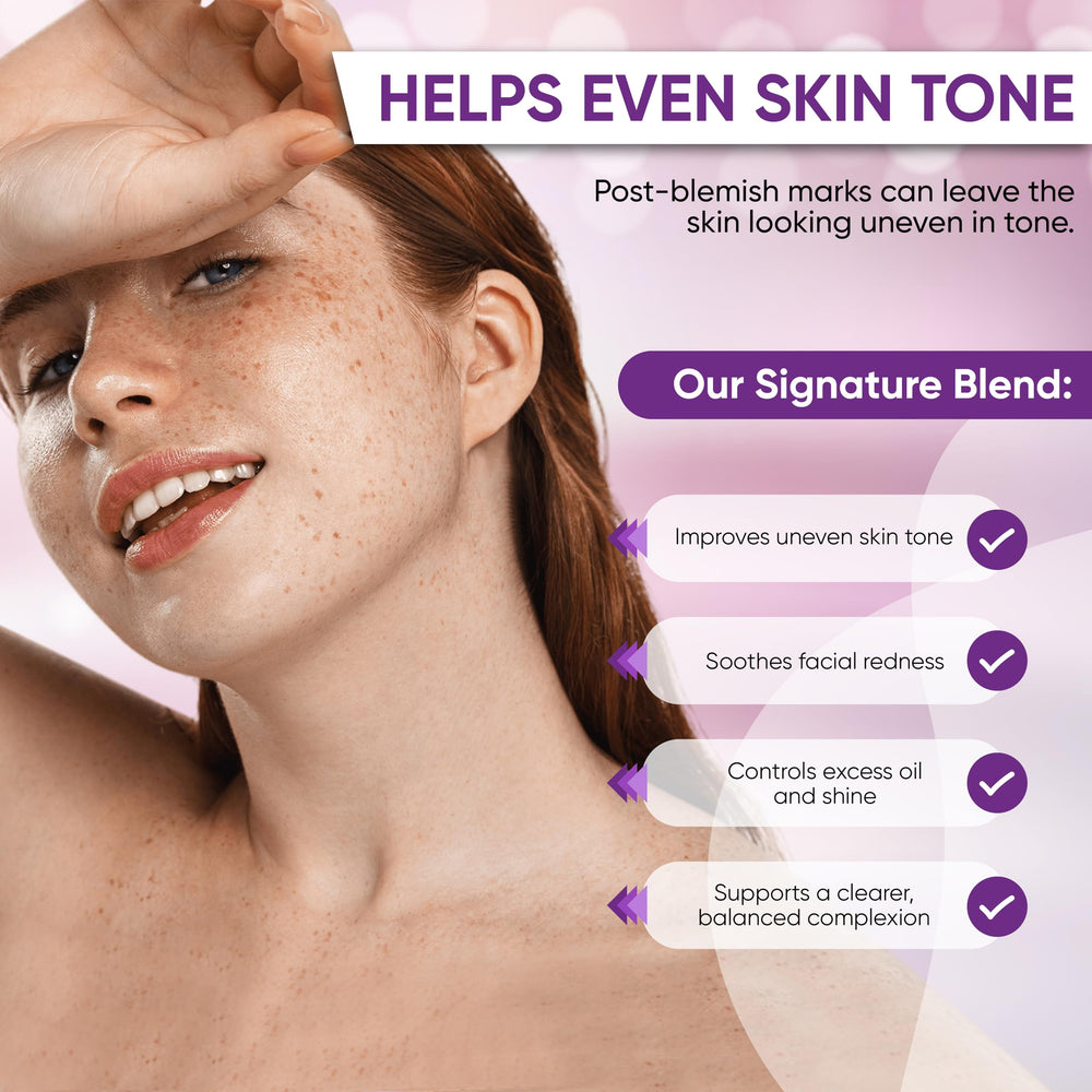 AOBBIY Azelaic Acid Cream soothing redness across the skin.