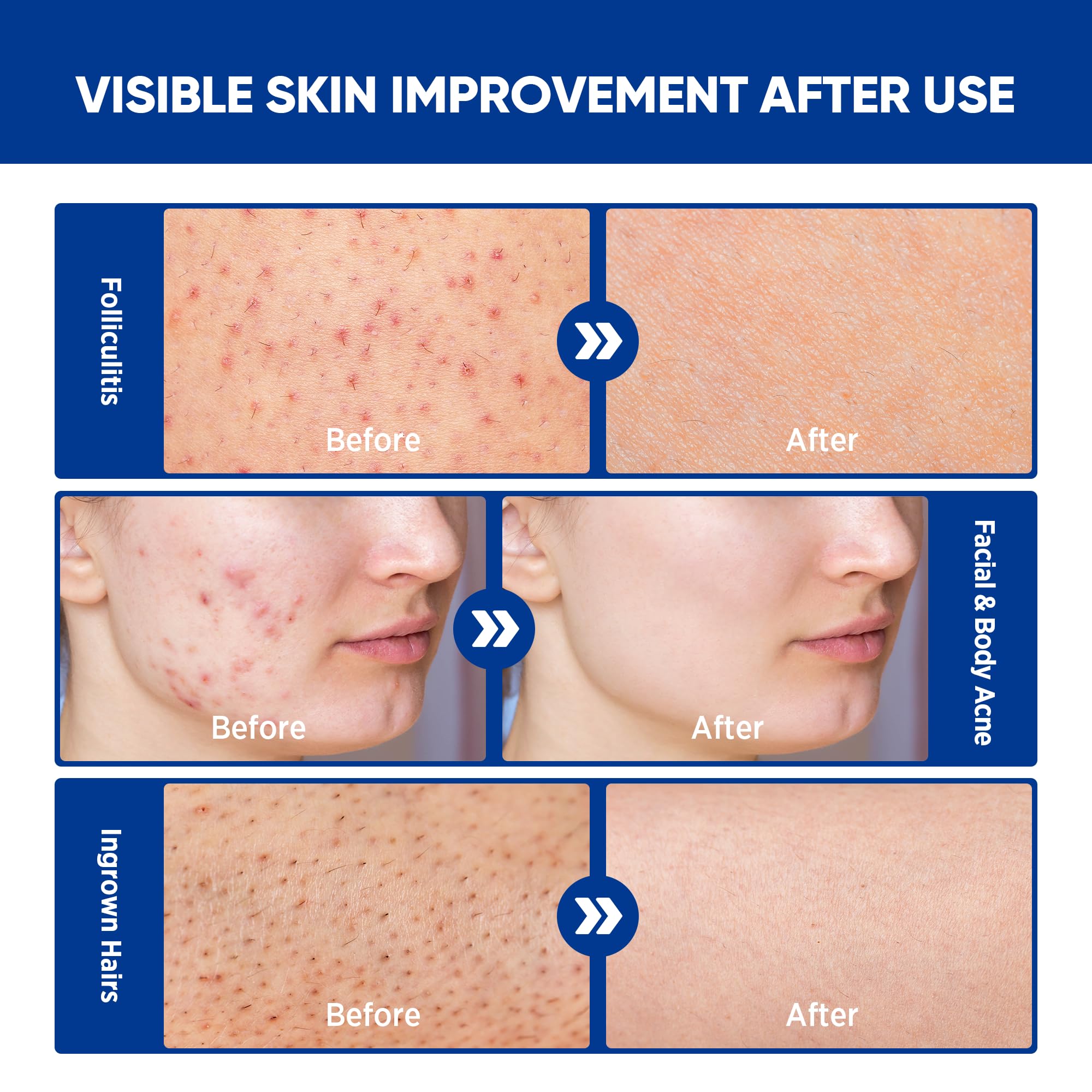 AOSORW facial care scene emphasizes soothing relief for redness and itch.