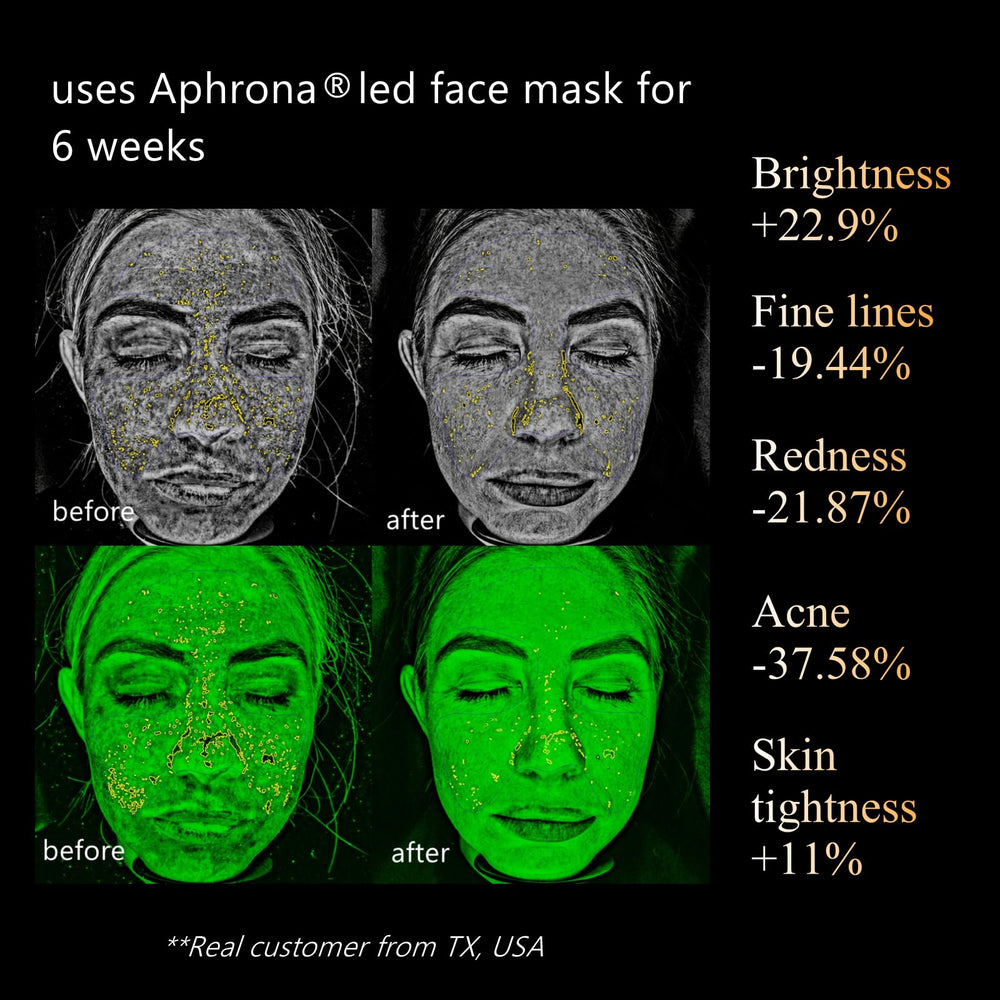 Aphrona Halo LED chip close-up showing multiple wavelengths for targeted skin care