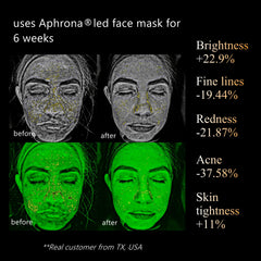 Aphrona Halo LED chip close-up showing multiple wavelengths for targeted skin care