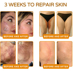 APKAPK Bee Venom Cream application scene demonstrates gentle massage for routine.