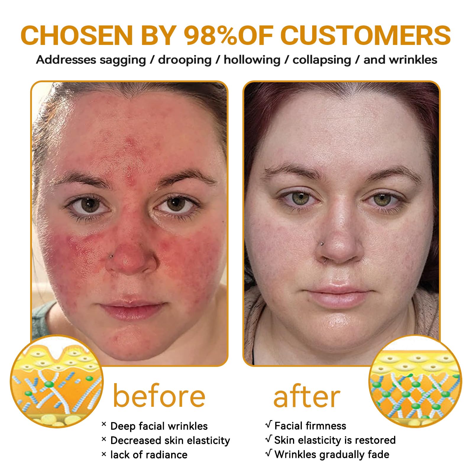APKAPK VLSVLS cream texture closeup illustrates non-irritating, calming formula.