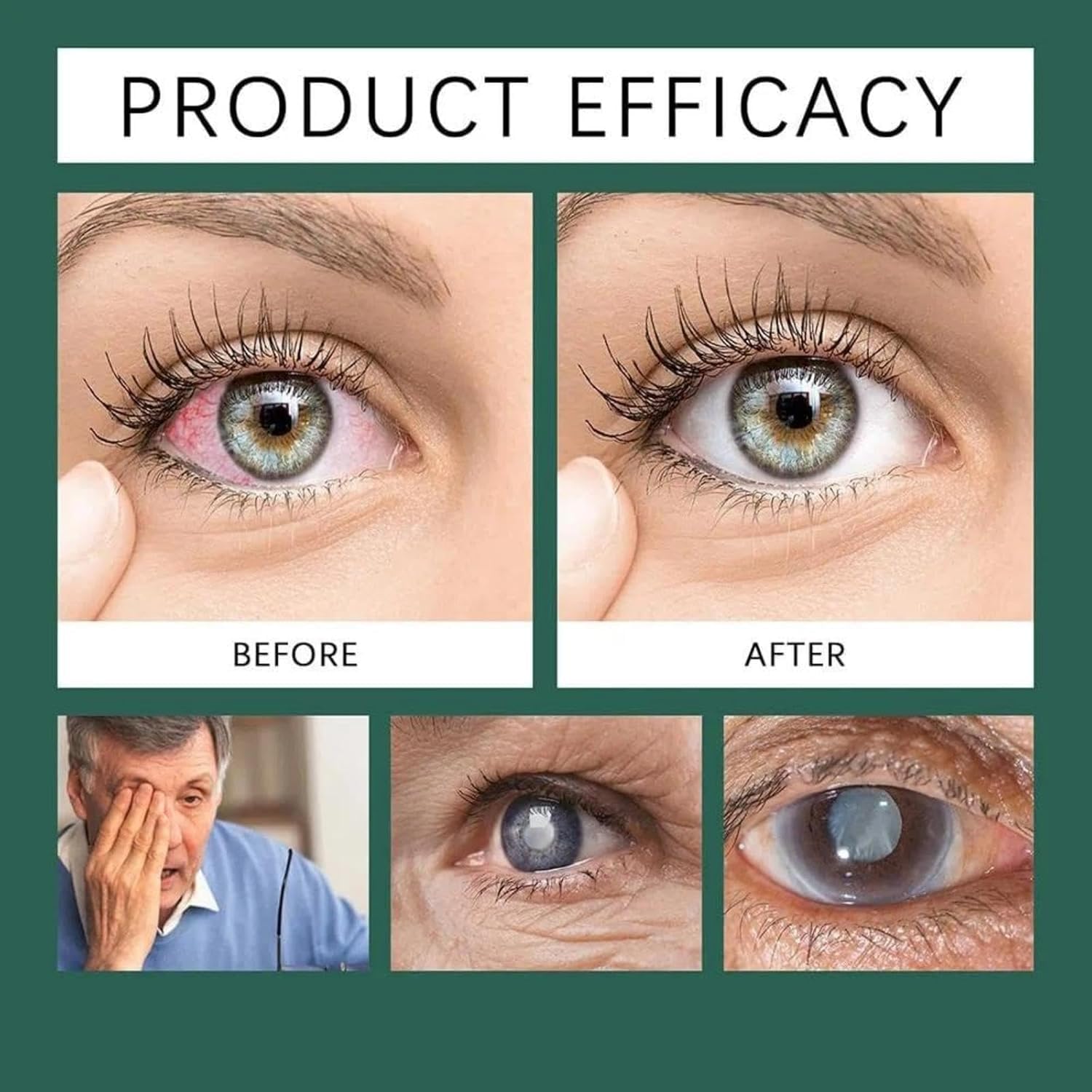 APOLO Optifusion Drops lutein vitamin c e image signals antioxidant protection.