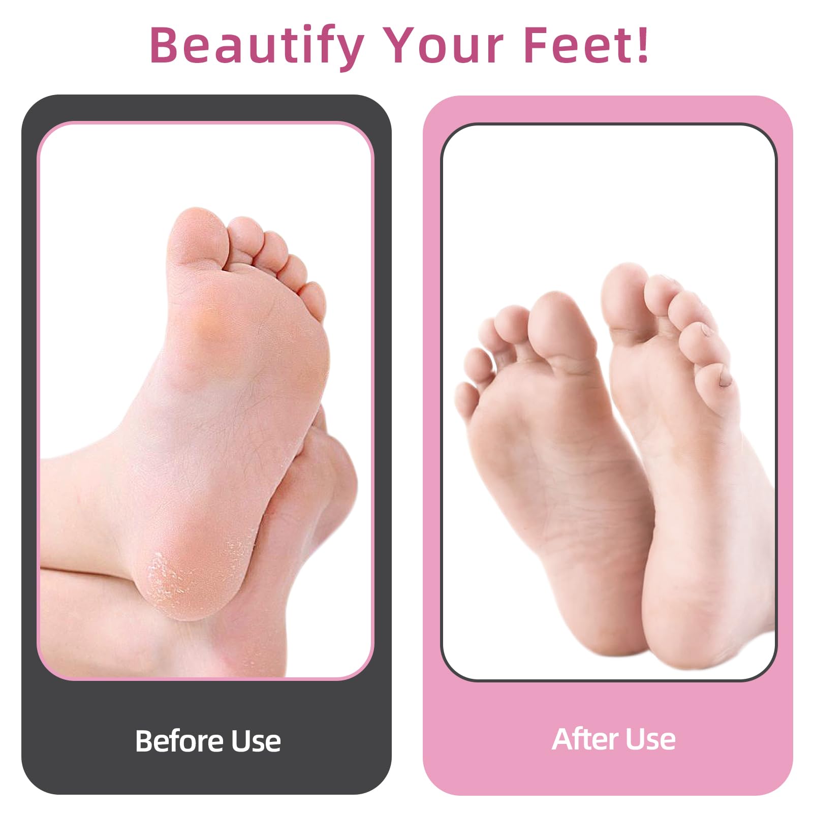 APRELM AprElm 4.8-inch longer body offers comfortable grip during pedicure sessions.