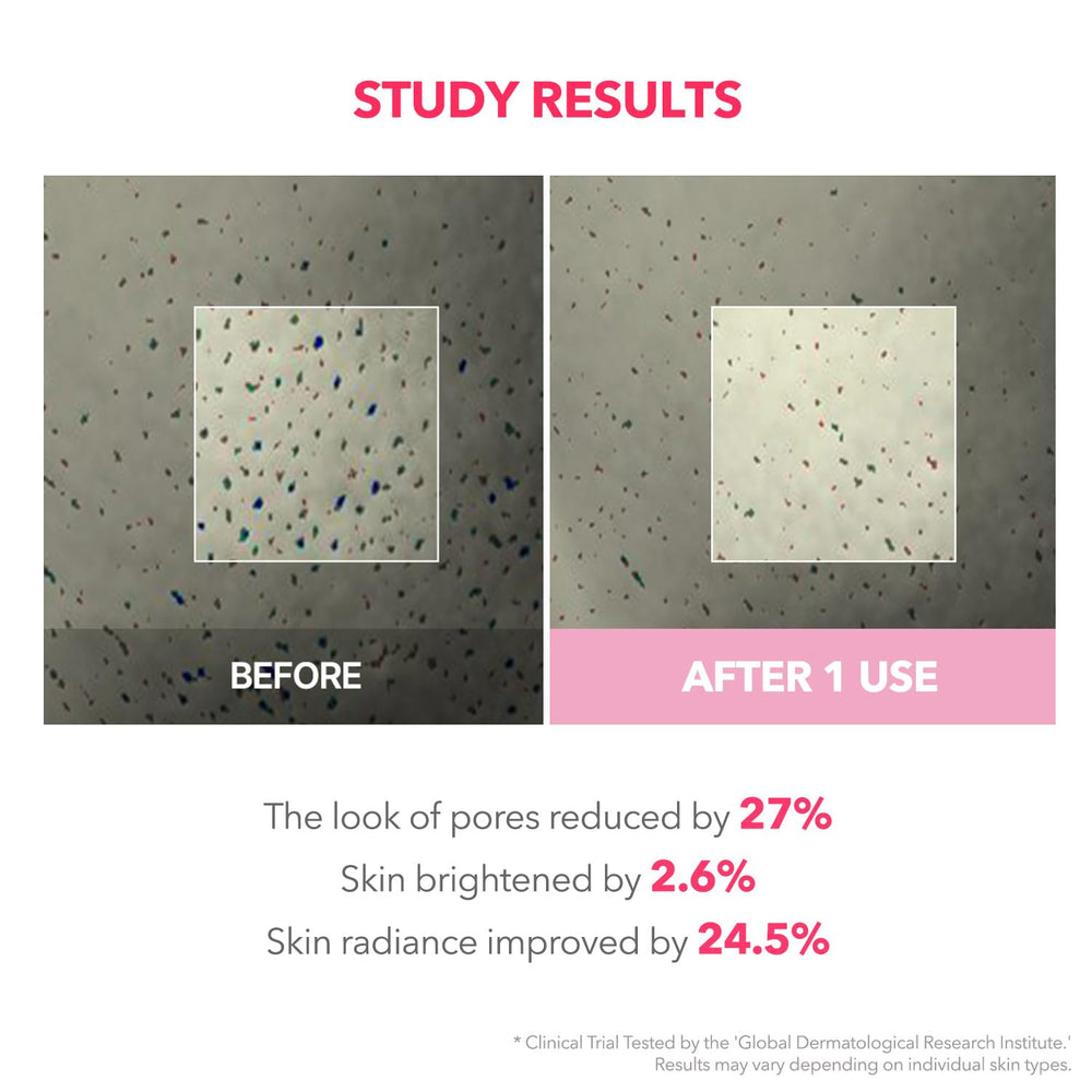 APRILSKIN TXA Niacinamide application on skin at night supports overnight tone refinement