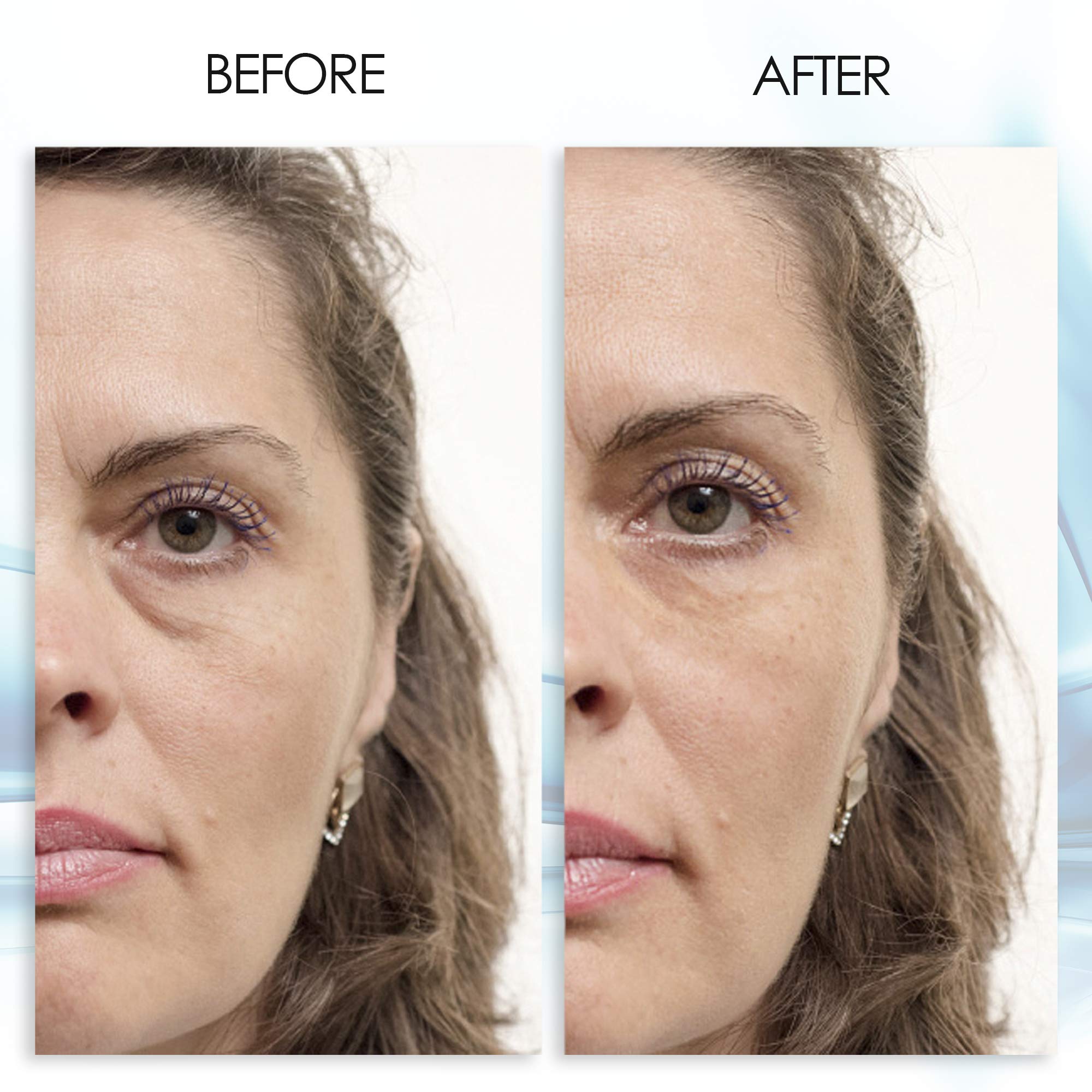 Aqua Mineral Puffy Eye Gel applied to under-eye area for puffiness reduction