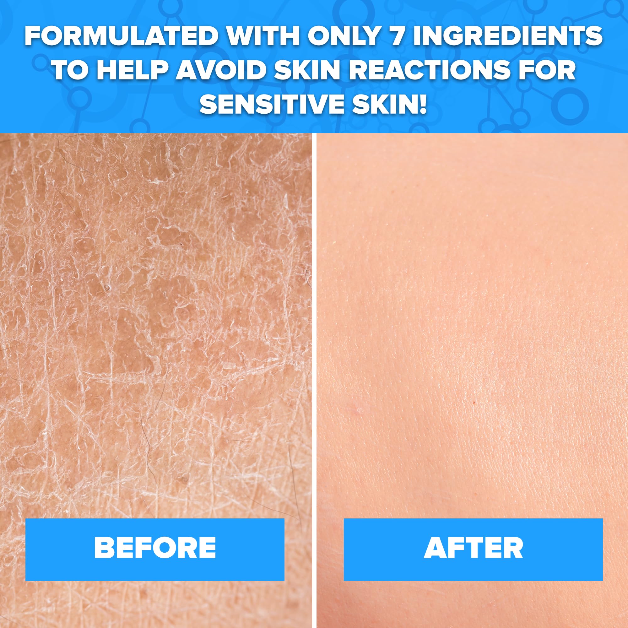 Aquanil cleanser label-close emphasizes dye-free and non-comedogenic benefits