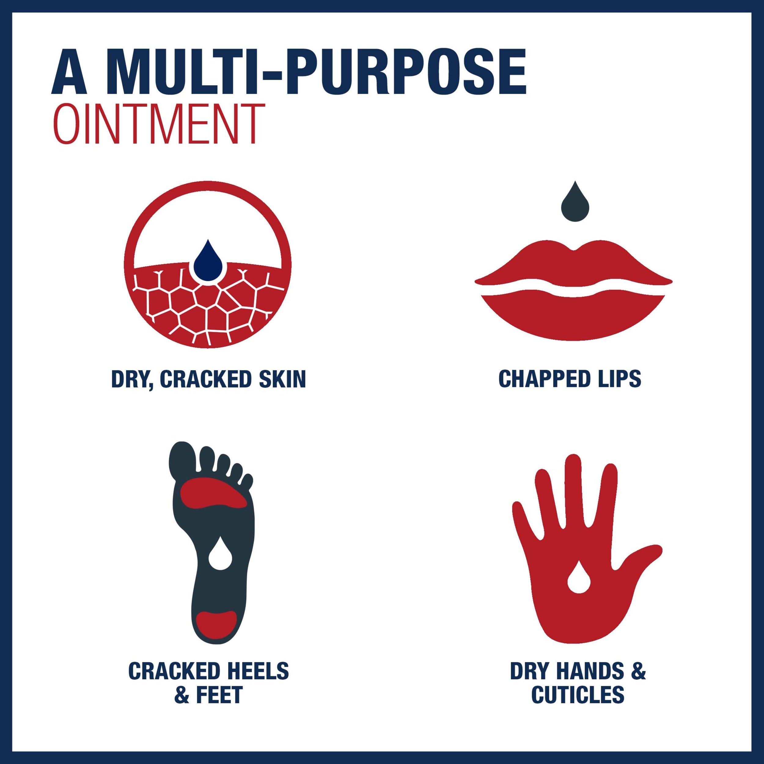 Aquaphor tube included inside a first-aid kit offering protective wound care benefit