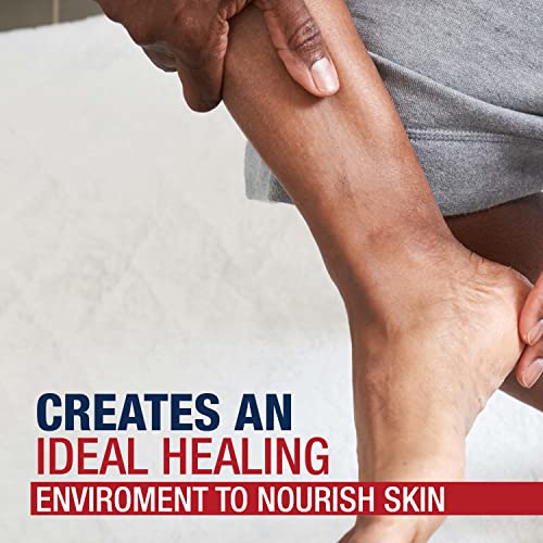 Aquaphor Healing Ointment protects skin from wind and cold.