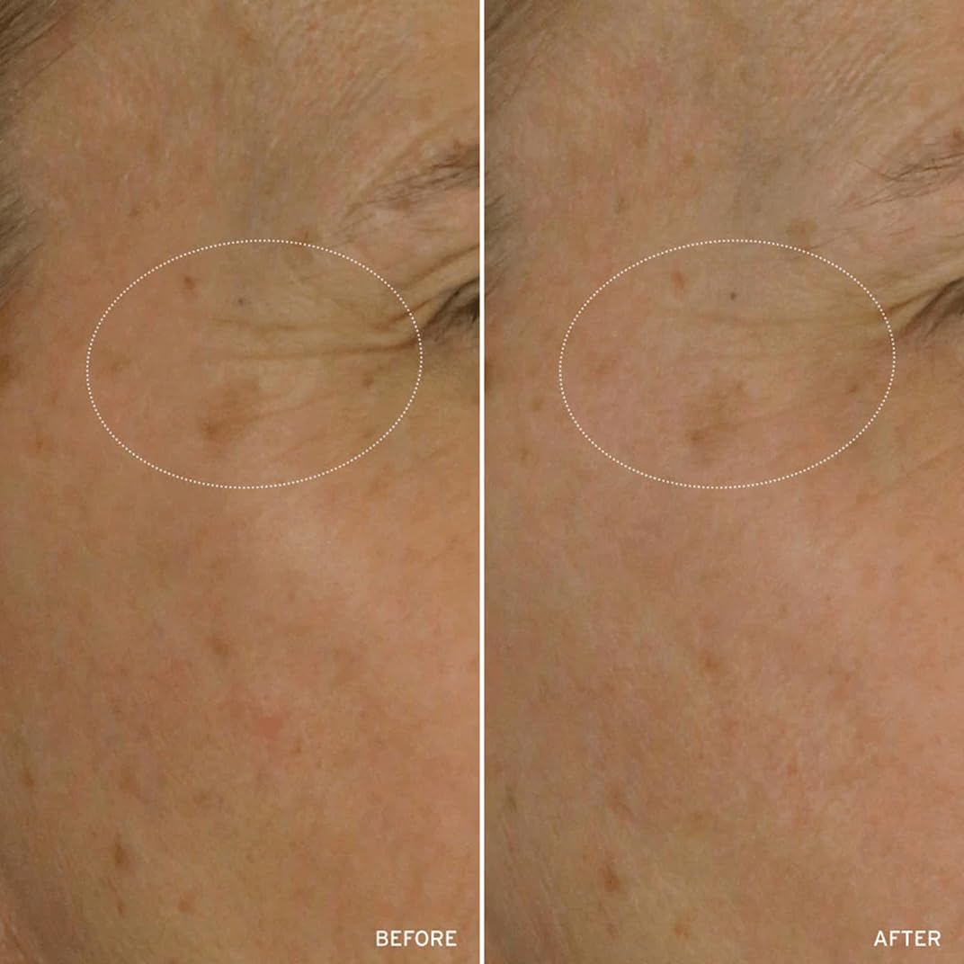 Aramore NAD+ Treatment in morning routine for daily vitality.