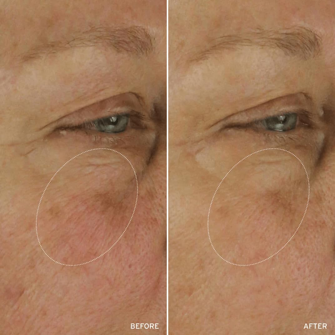 Aramore NAD+ Treatment radiance close-up on skin.