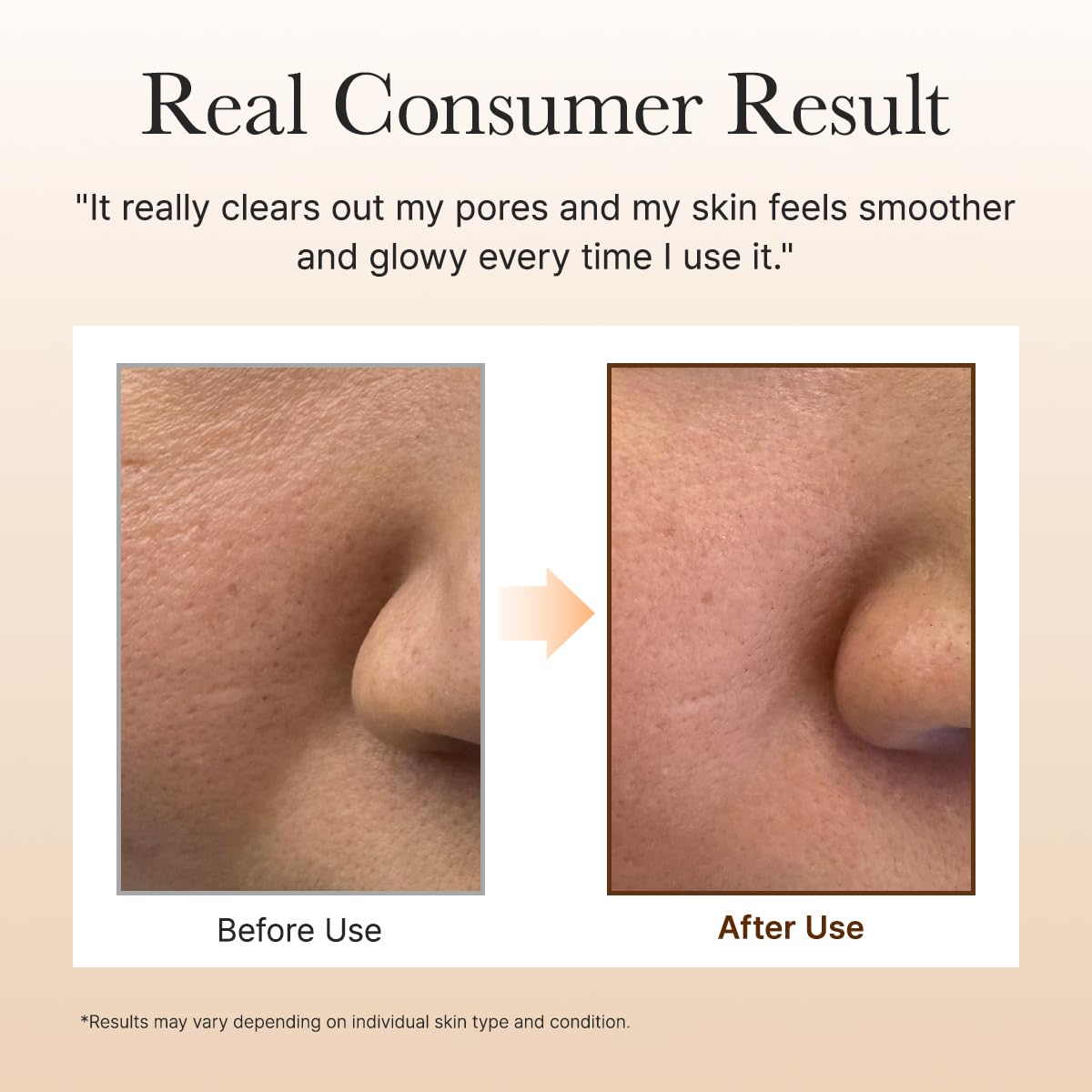 ARENCIA Calendula Rice Mochi Cleanser packaging shows the 4.23oz bottle for home use.