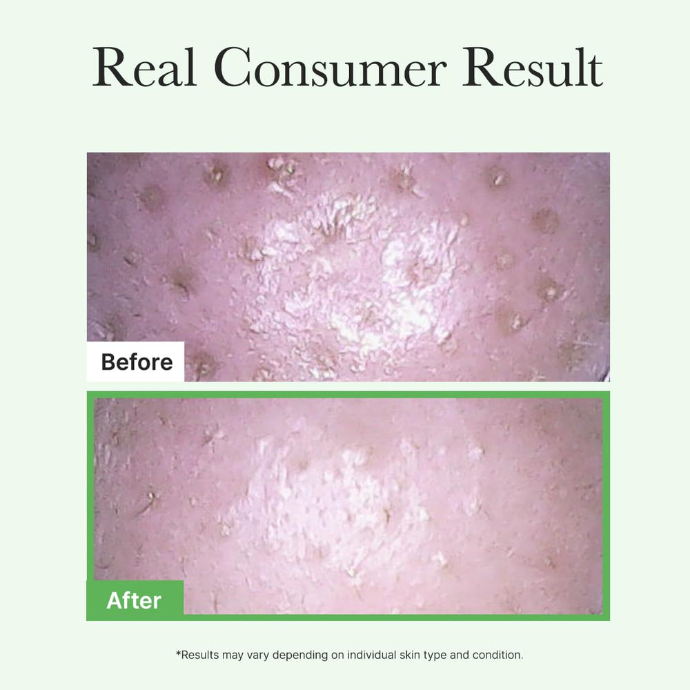 Vitamin E at work in ARENCIA Pore Melt Mochi for a lightweight protective feel