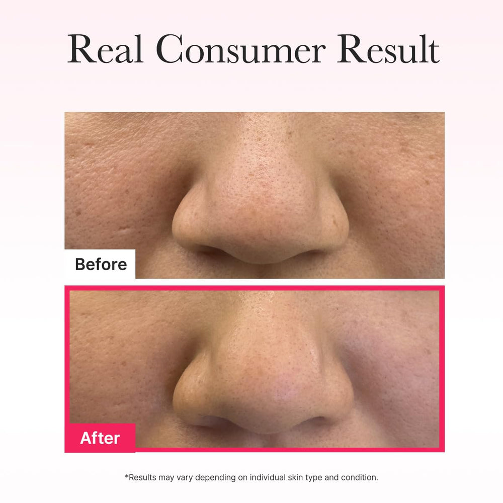 ARENCIA 2% niacinamide supports tone and texture with gentle resurfacing effects