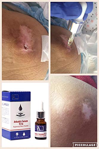ARKADA Natura Resort AMAZON TC16 Serum texture swatch on skin showcases a lightweight, fast-absorbing feel.