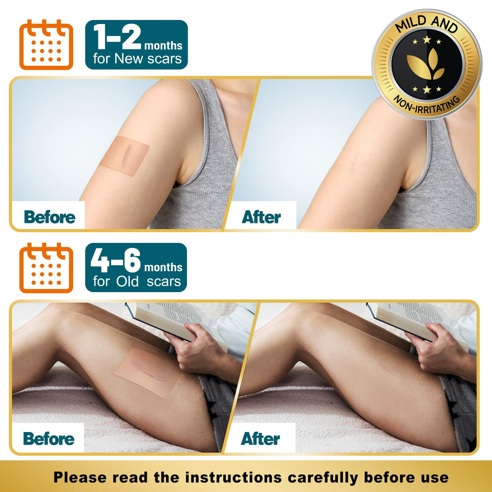 Arme 4-roll pack emphasizes bulk, cost-effective scar care solution
