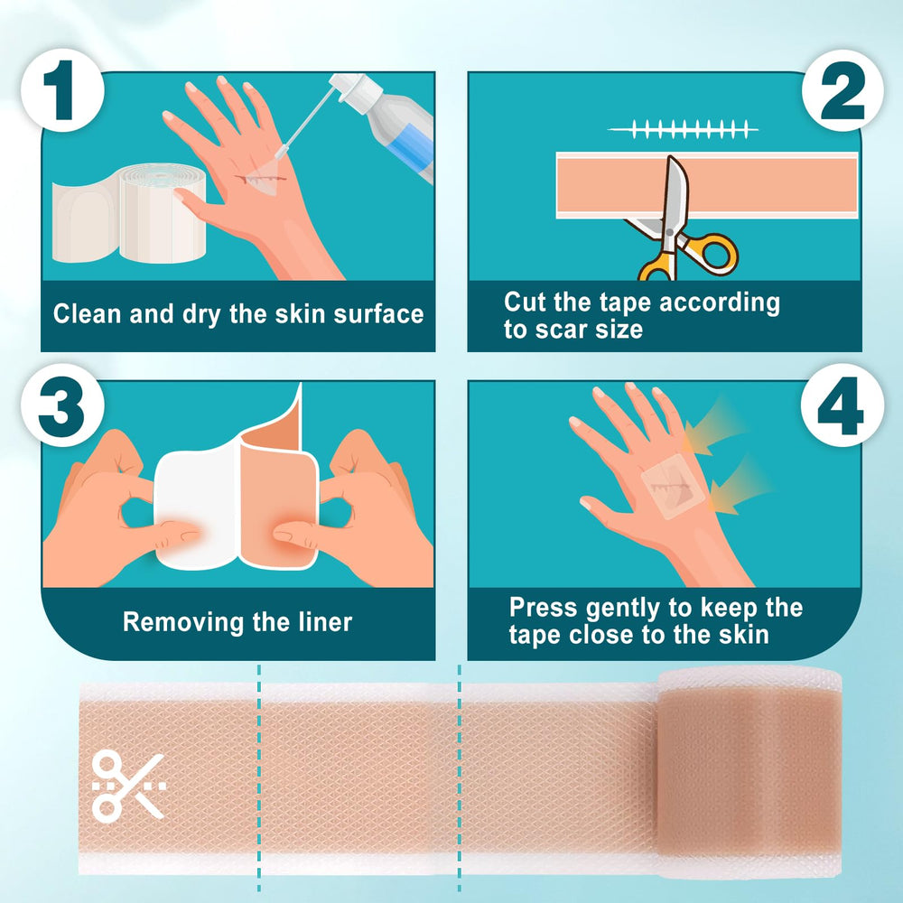 Arme silicone scar tape for C-section or abdomen scar offers gentle, protective coverage.