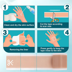 Arme silicone scar tape for C-section or abdomen scar offers gentle, protective coverage.