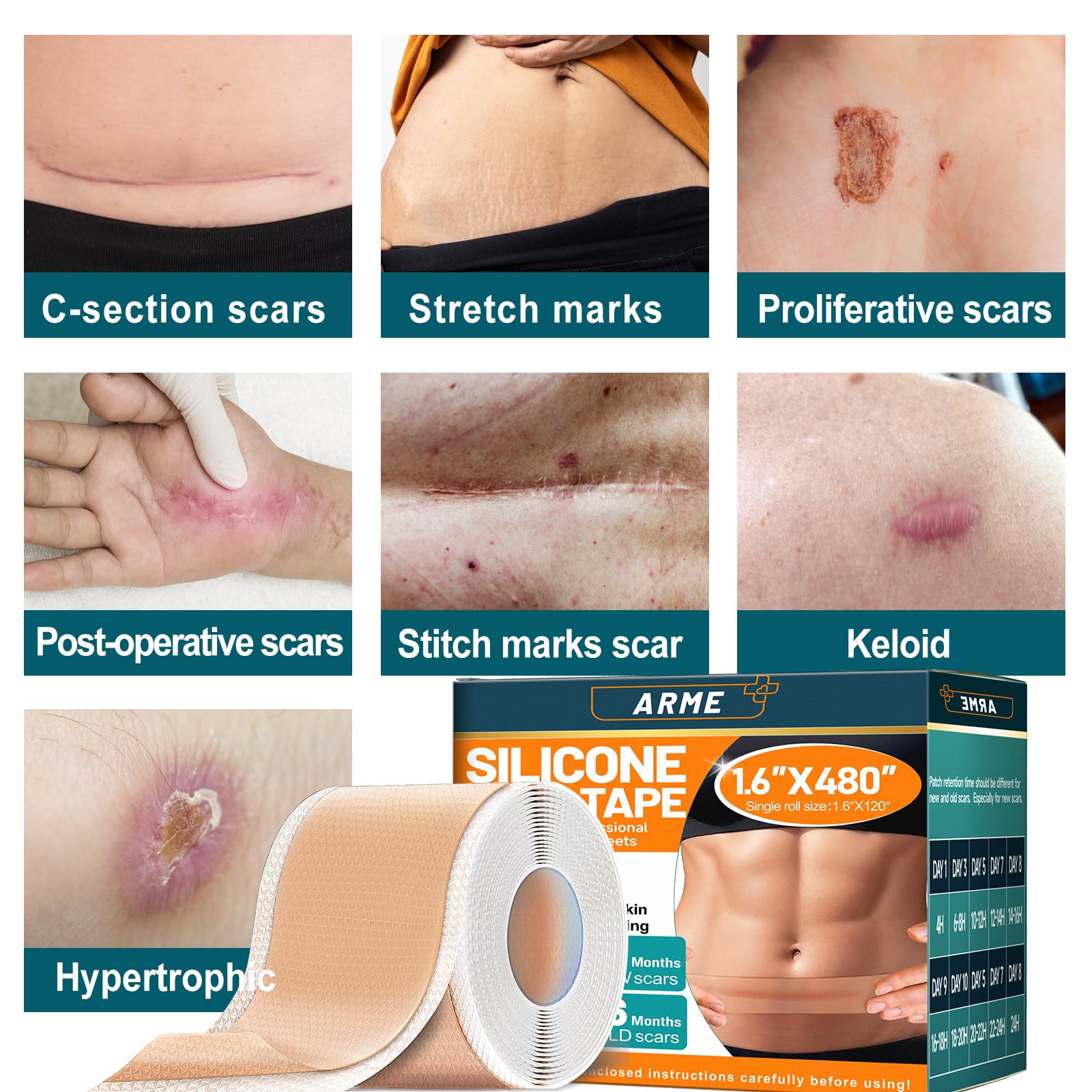 Arme silicone scar tape in daily-use setting maintains adhesion after washing.