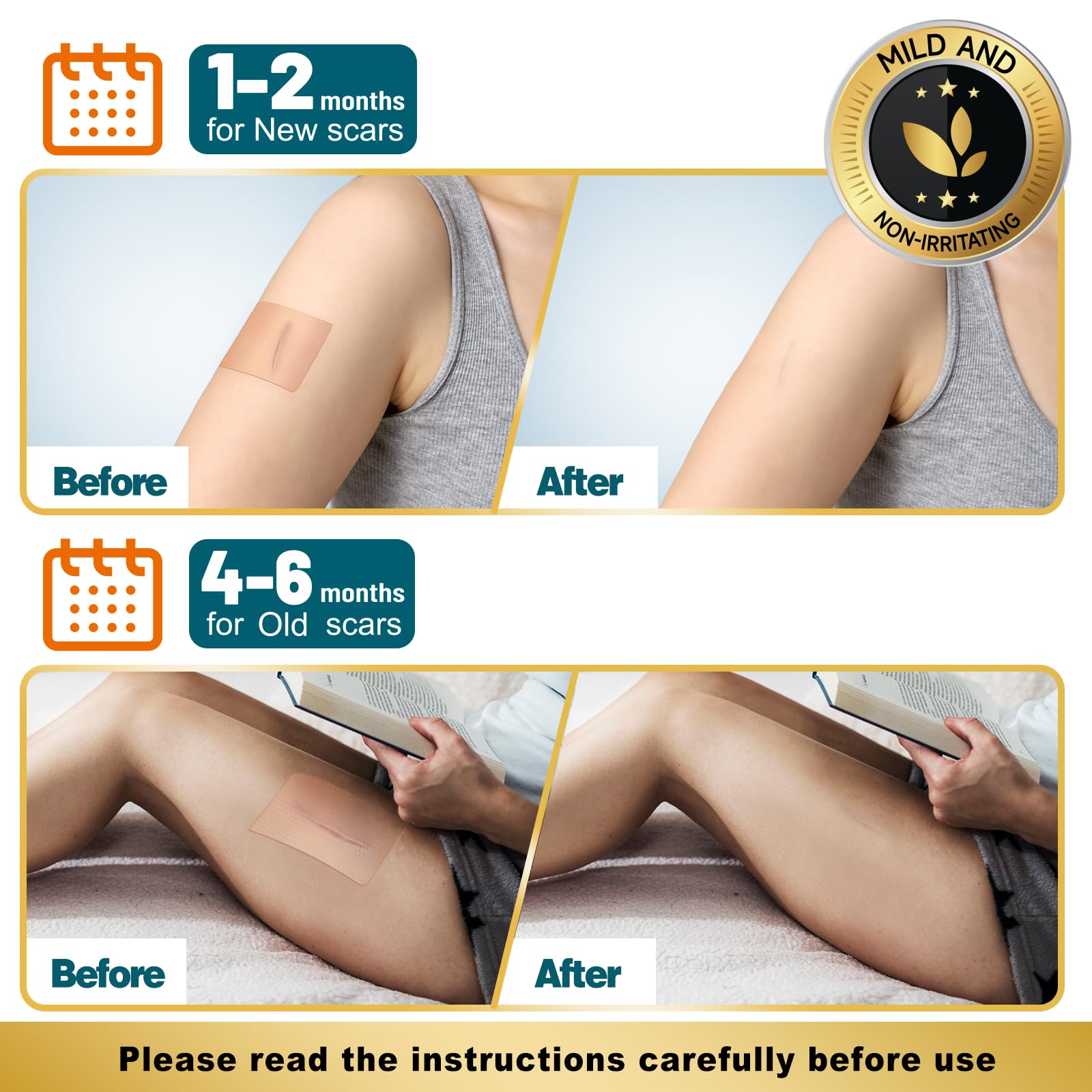 Arme silicone scar tape tummy-tuck scar use supports hydration and friction-free wear.