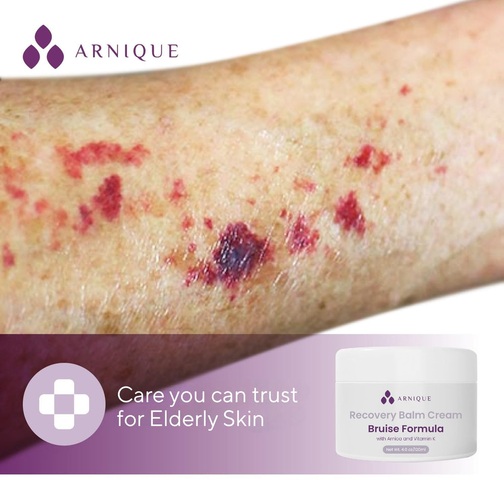 Arnique Arnica Bruise Cream Tube enables precise application on arms and legs.