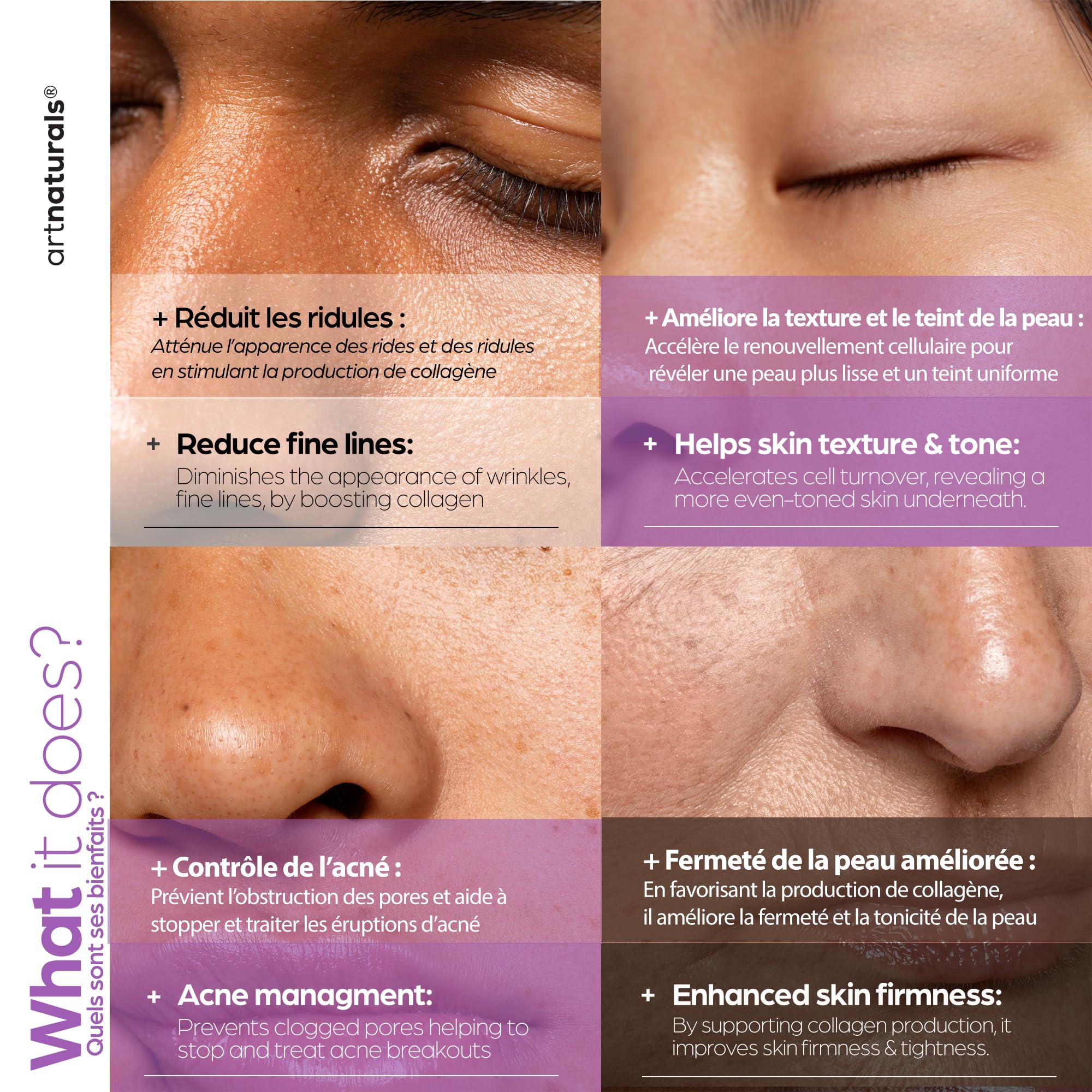 ArtNaturals suero retinol rostro, ácido hialurónico para hidratación intensa.