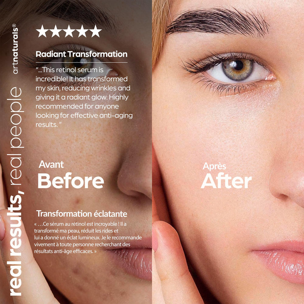 Rutina nocturna con ArtNaturals, suero de retinol para rostro.