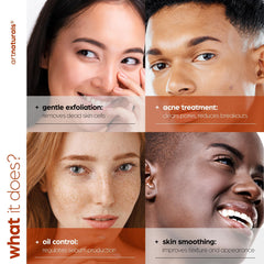 artnaturals Salicylic acid Serum dropper closeup highlighting 2% BHA action for shine reduction.