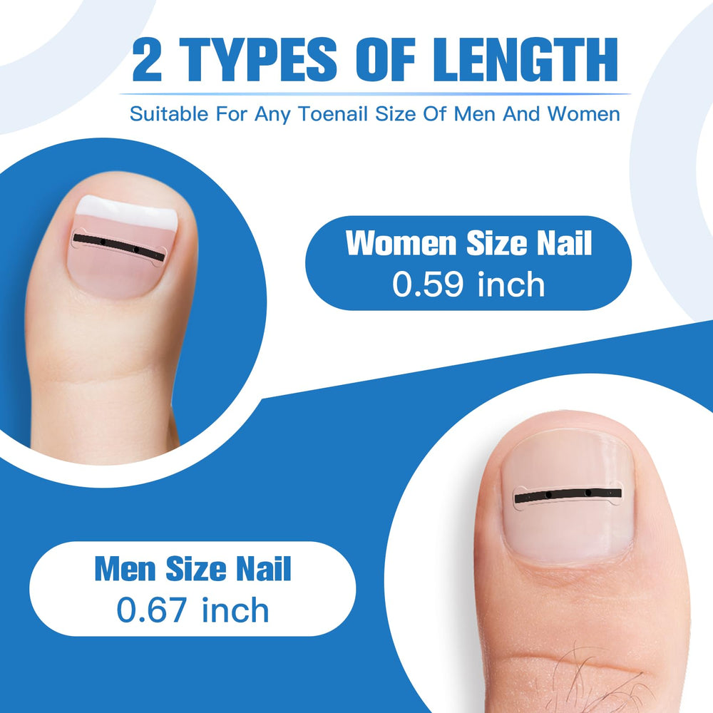 Asinkiher bendable ingrown toenail corrector demonstrates resilience without deformation