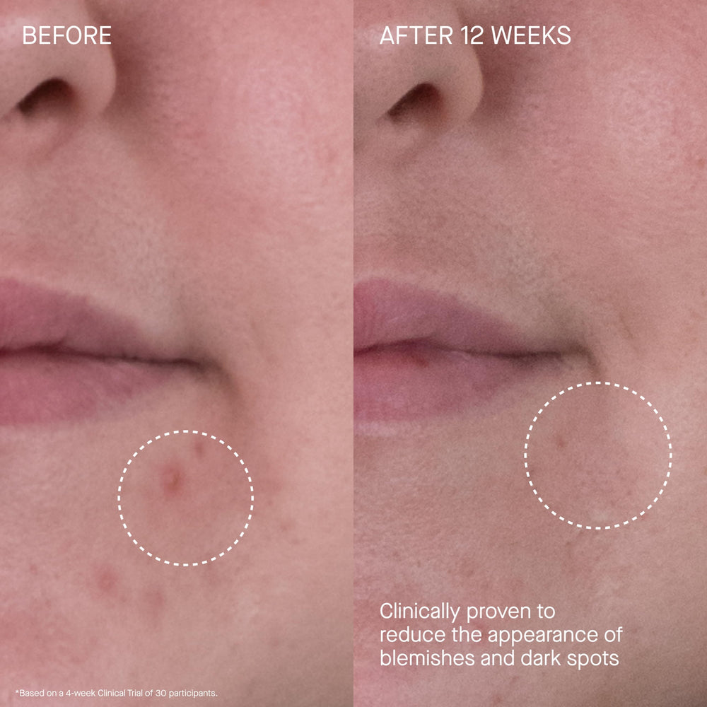 Augustinus Bader The Rich Cream face-neck-decolletage swatch for glow and even tone.